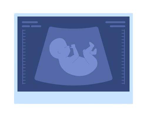 Gender scan Amman
